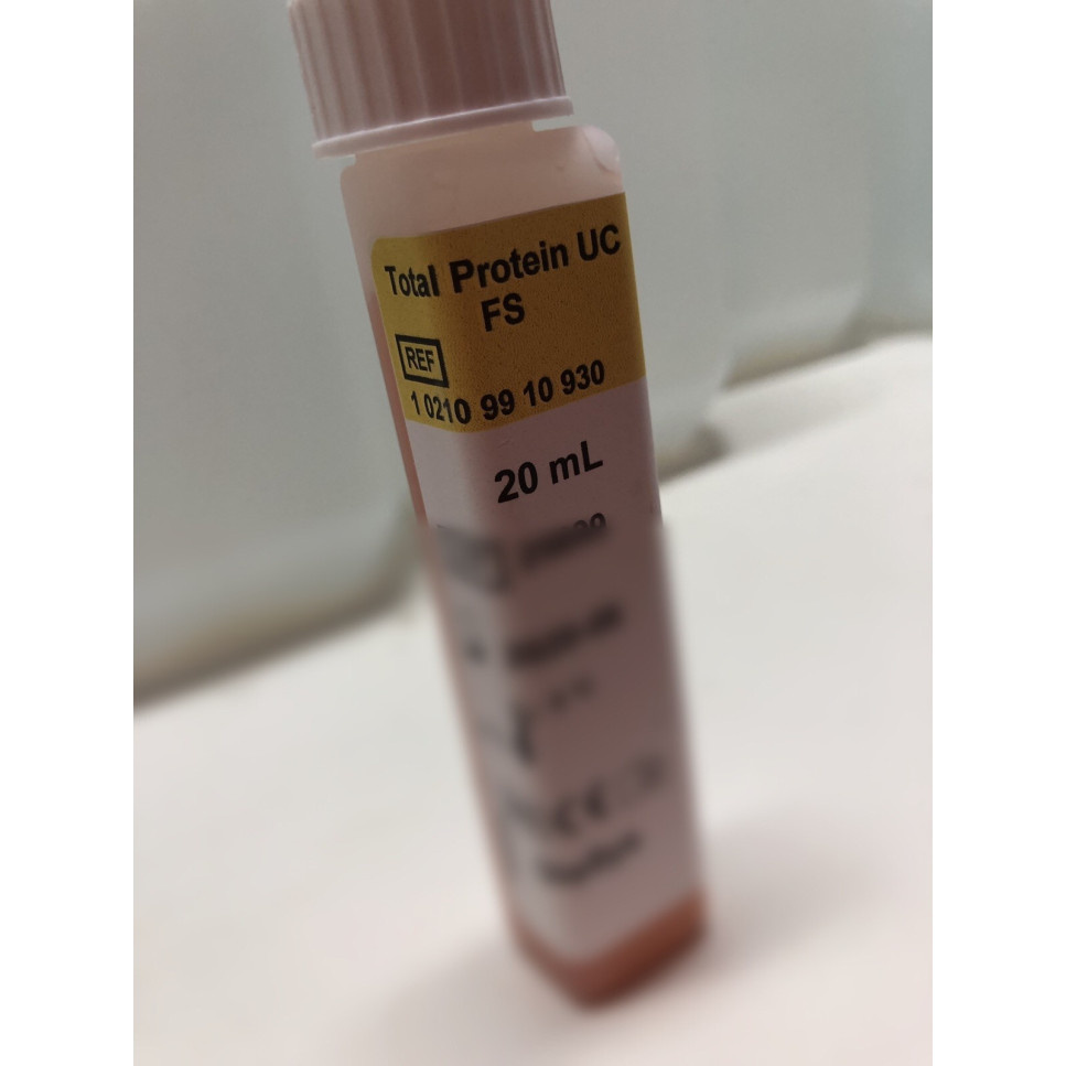 Proteinas Total UC FS